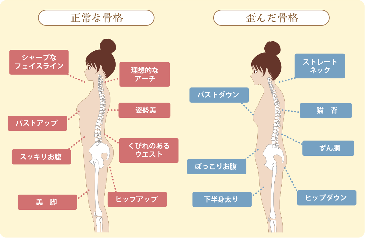 正常な骨格 歪んだ骨格 イメージ画像