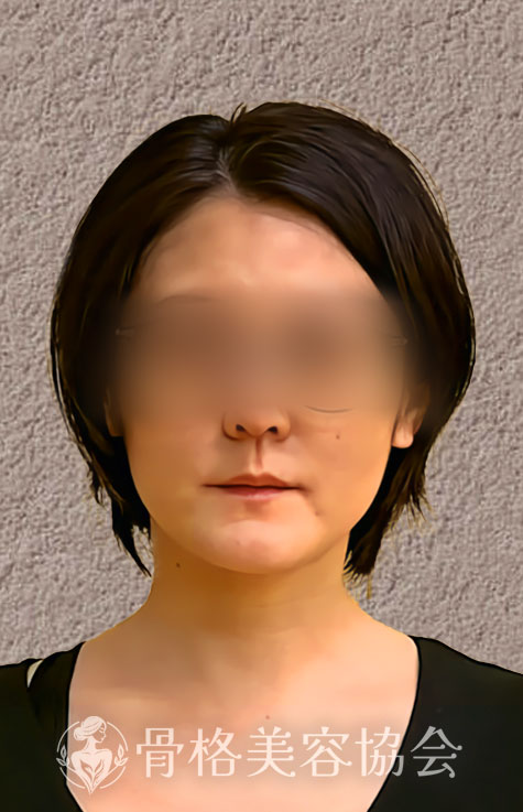 骨格美容とは 3ヶ月での変化 イメージ画像1