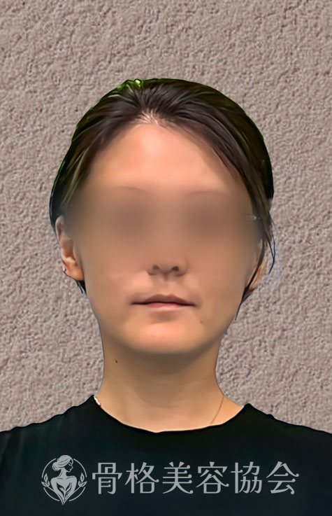 骨格美容とは 3ヶ月での変化 イメージ画像3
